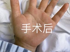 -重庆医科大学附属第一医院(本部)