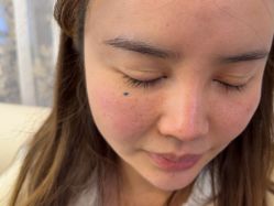 -长沙雅美医疗美容医院