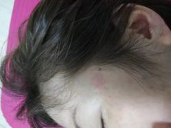 -美人痣全国连锁