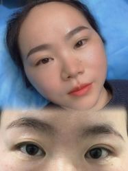 -郡艺医疗美容·微整·眼鼻吸脂