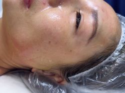 -长沙雅美医疗美容医院