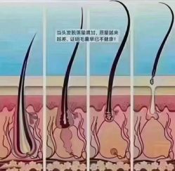 -木北造型