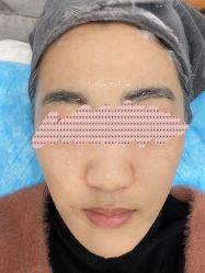 体验后-澳尔颜选医疗美容