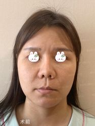 -北京米扬丽格医疗美容·联合丽格鼻整形中心