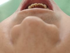 -精德口腔·种植修复·儿牙中心(财富中心店)