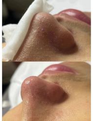 -SOS修丽可.痘肌修复中心