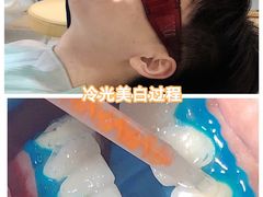 -团圆口腔·种植中心(锦江院区)