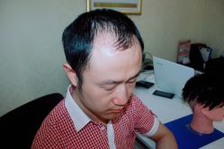 -大麦微针植发全国连锁