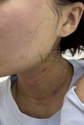 -深圳春天阳光医院·轮廓抗衰中心