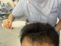 -大麦微针植发全国连锁