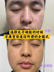 -小忠丽格医美