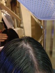 -碧莲盛·不剃发植发