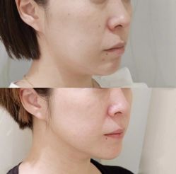 -上海漾颜医疗美容