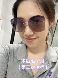 -上海时光整形外科医院