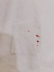 -塑青春&伊肤泉祛痘皮肤管理