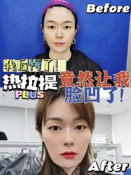 -深圳美莱医疗美容医院