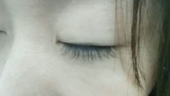 点击看大图 android_upload_pic-依萱绮医疗美容