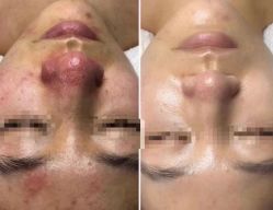 点击看大图 -薇薇安花系SPA