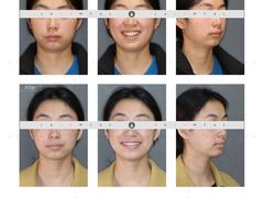 -齐玉齿科JADENTAL