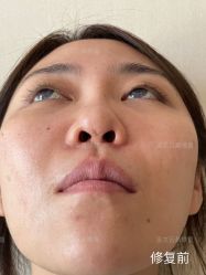 -北京米扬丽格医疗美容·联合丽格鼻整形中心