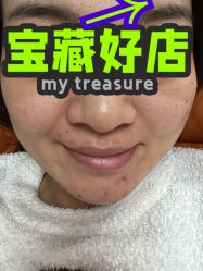 体验前-纯粹医美