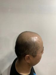 -发饰美男士增发补发假发定制店