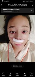 点击看大图 -成都艾特他整形外科医院