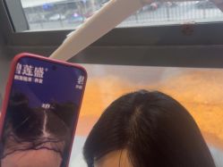 -碧莲盛·不剃发植发