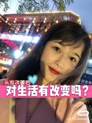 -大麦微针植发全国连锁