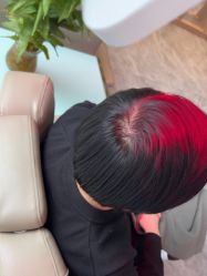 -碧莲盛·不剃发植发