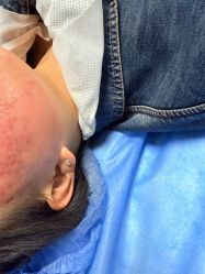-四川米兰柏羽医学美容医院