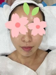 体验前-坤如玛丽·医疗美容中心