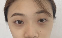 -天津健丽·去眼袋医疗美容机构
