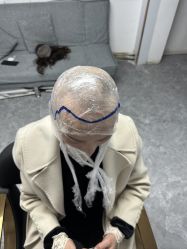 -卡诗亚女士隐形假发增发补发定制店