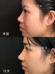 -北京米扬丽格医疗美容·联合丽格鼻整形中心