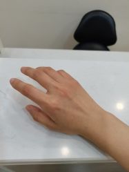 点击看大图 -嘉和医学脱毛中心