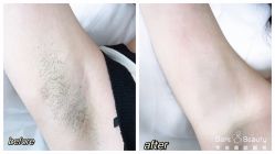 -植蔻妍倍儿专业脱毛·皮肤管理