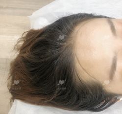 -西施无菌半永久纹绣眉眼影唇轻增发纹发际线