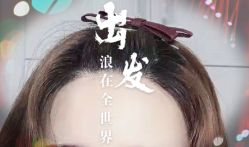 -大麦微针植发全国连锁