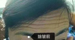 体验前-美莱医学美容医院