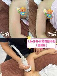 -Lily纤美·科技减脂中心