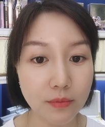 -南京健丽·去眼袋医疗美容机构