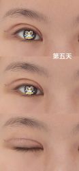 体验后-Yestar艺星整形美容医院