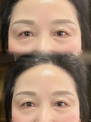 点击看大图 -张小野·专业半永久纹眉