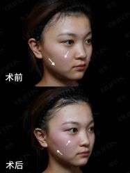 点击看大图 -AURAS璈然科技护肤中心