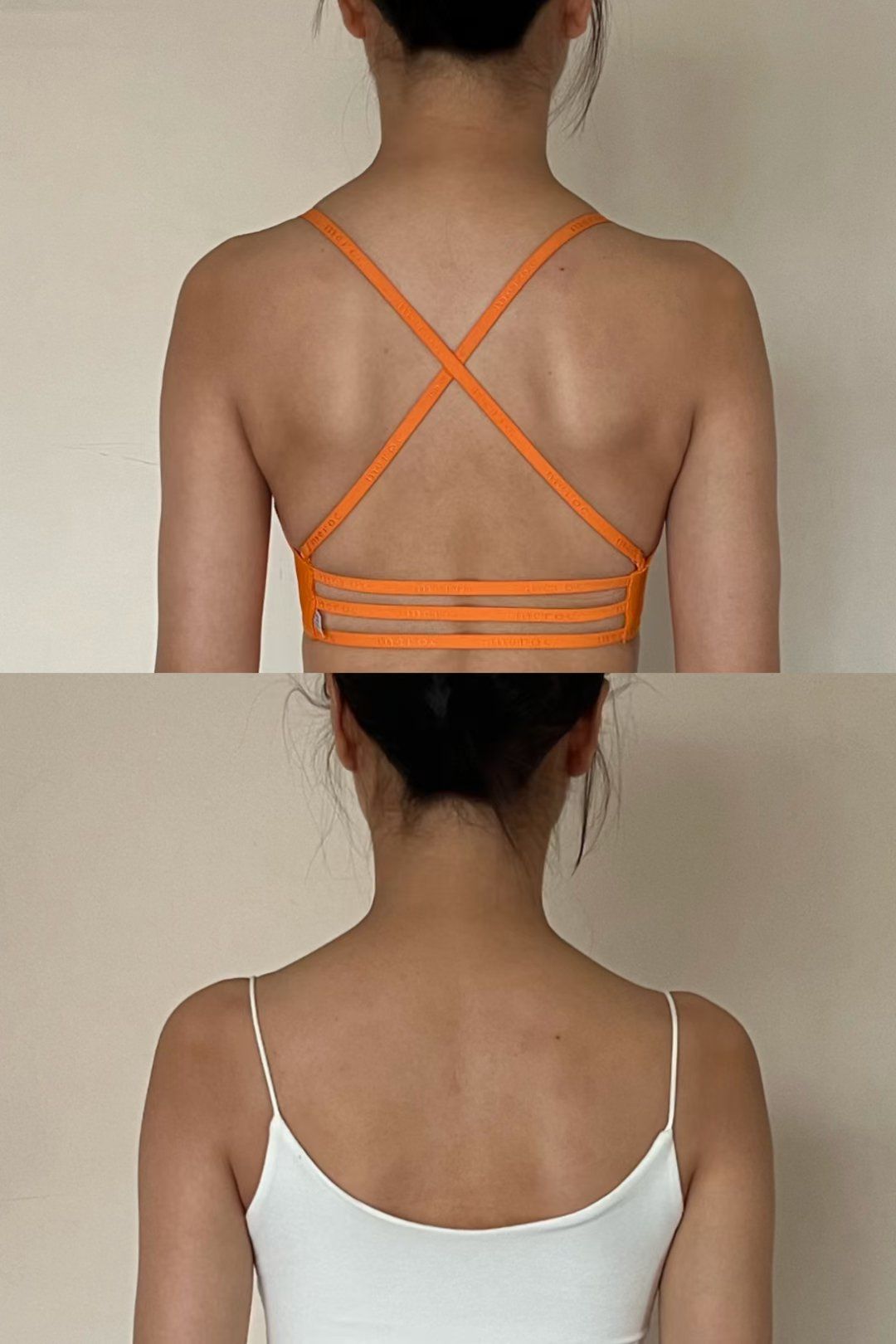 翼状肩胛调整案例