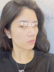 体验前-广州美莱医疗美容医院