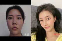 -成都西区医院整形美容