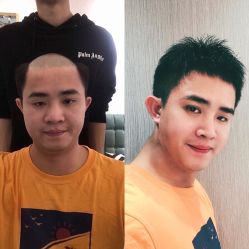 -发饰美男士增发补发假发定制店