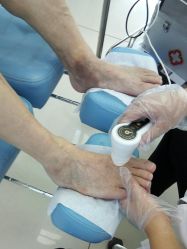 -派恩宜灰指甲鸡眼嵌甲手足癣